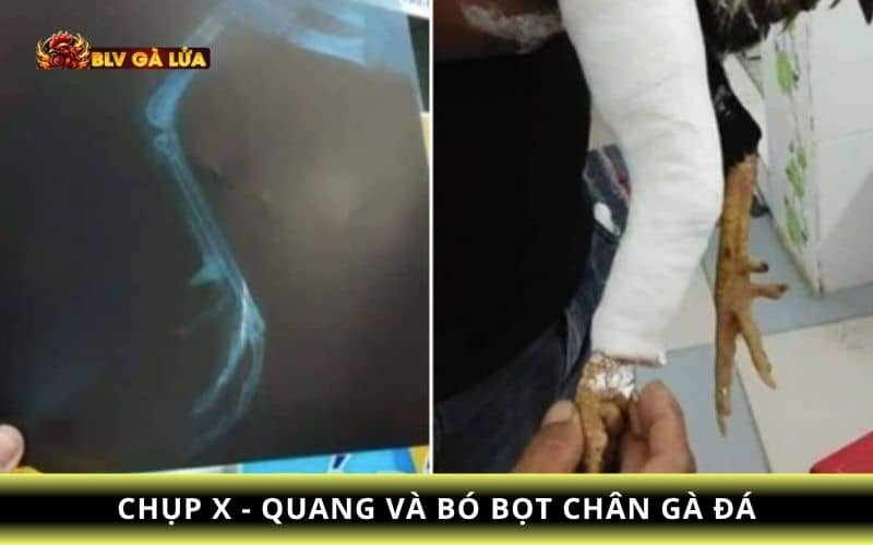 Bó bọt cho chân gà đá bị gãy Bó bọt cho chân gà đá bị gãy
