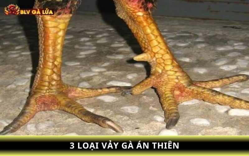 Các vảy án thiên phổ biến hiện nay Các vảy án thiên phổ biến hiện nay